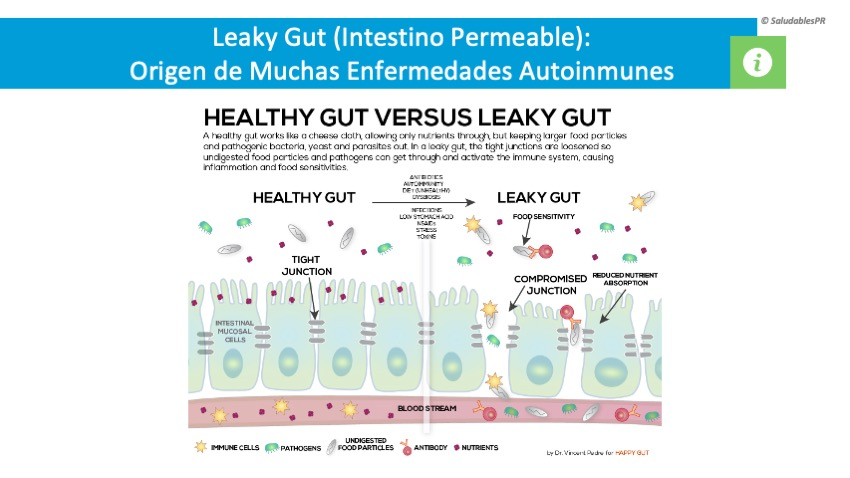 DC 4 03 Leaky Gut